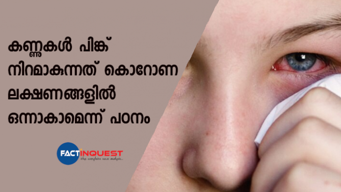 Pink Eye May be Primary Symptom of Covid-19, Conjunctivitis Found in 10-15% of Cases