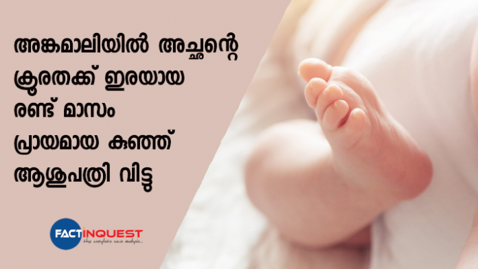 two month old baby who was heavily injured after father throw it to the bed discharged