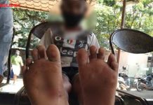 Minor boy brutally attacked in Kochi